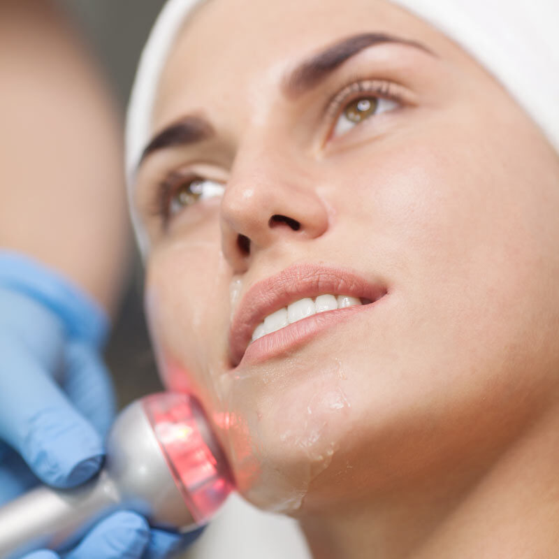 RADIO FREQUENCY FACIAL The Wrinkleroom Carmarthen